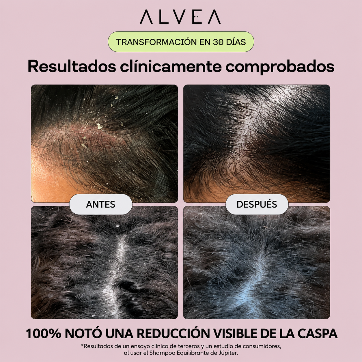 ALVEA | Shampoo equilibrante. Combate la Caspa, Picazón y Dermatitis Seborreica