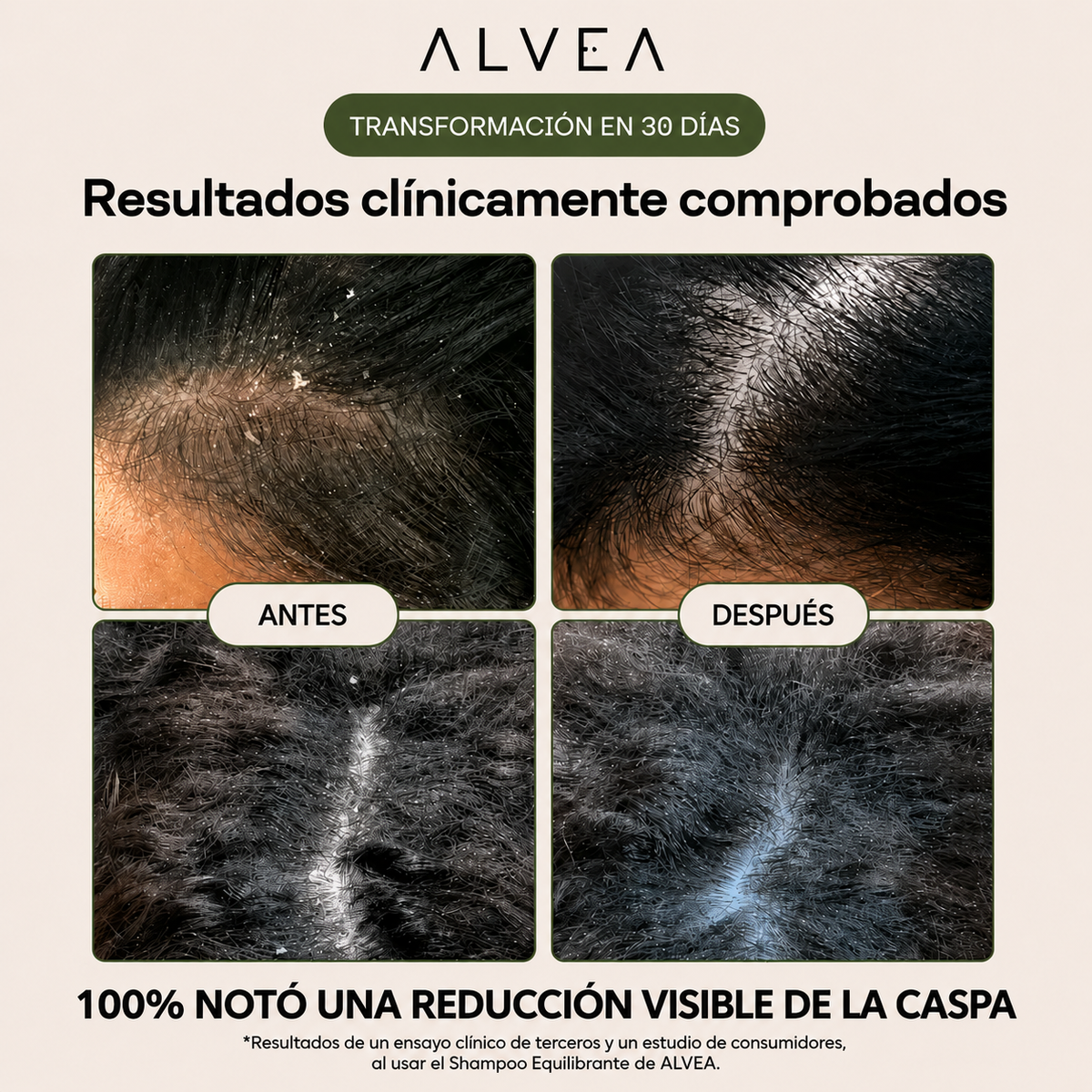 ALVEA | Shampoo equilibrante. Combate la Caspa, Picazón y Dermatitis Seborreica